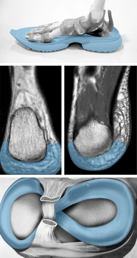 human biological structures heel and sole